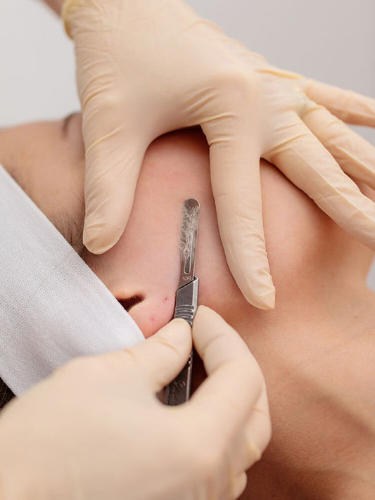 Is Dermaplaning For Everyone?