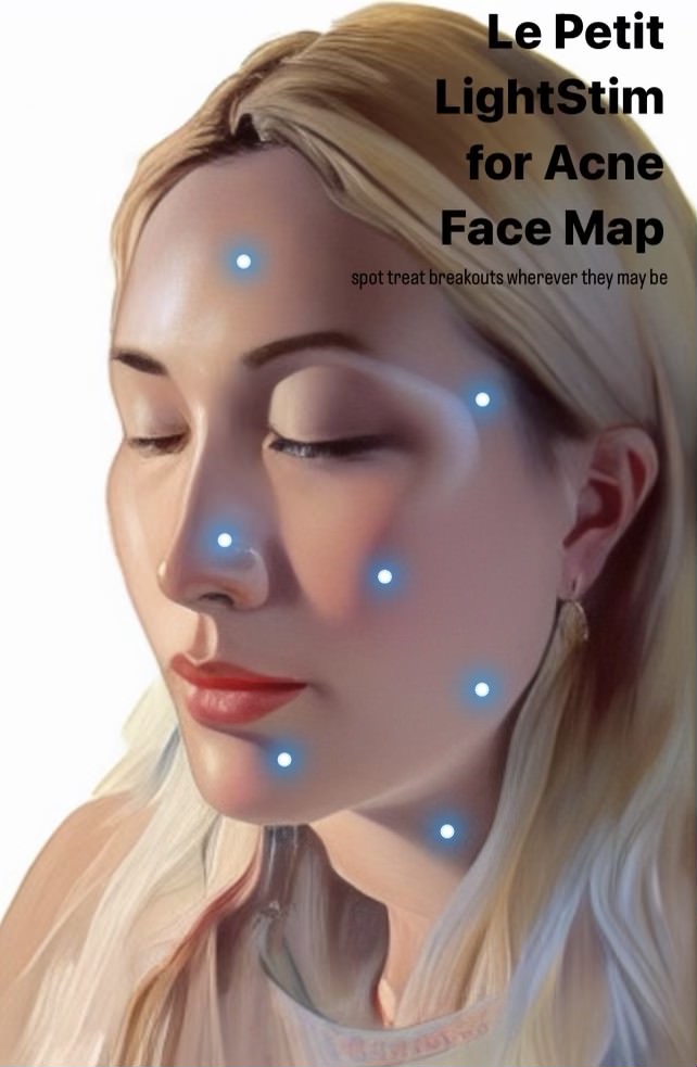 LightStim for Acne